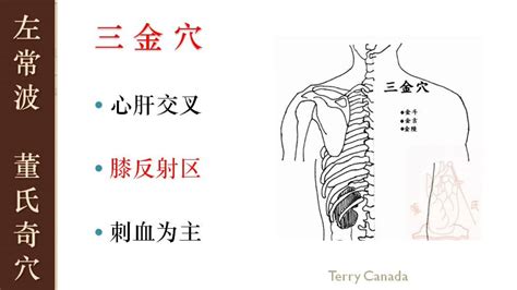 三金穴|三金穴在哪里